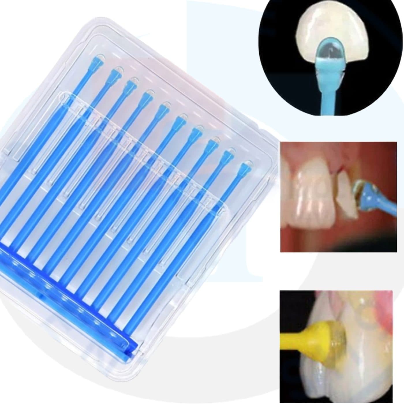 veneer tips(20pcs)